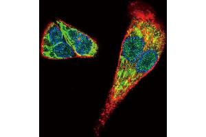 Immunofluorescence (IF) image for anti-Midkine (Neurite Growth-Promoting Factor 2) (MDK) antibody (ABIN2996524) (Midkine 抗体)