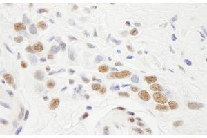 Immunohistochemistry (IHC) image for anti-Nuclear Transcription Factor Y, alpha (NFYA) (AA 333-347) antibody (ABIN7448690)