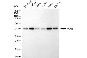 Western blotting analysis using PURB antibody (ABIN7800068).