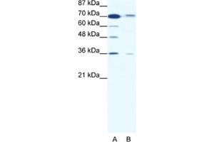 Western Blotting (WB) image for anti-SMAD Family Member 4 (SMAD4) antibody (ABIN2460350) (SMAD4 抗体)
