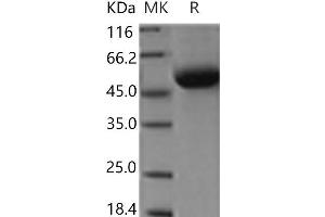 Western Blotting (WB) image for Discoidin Domain Receptor tyrosine Kinase 1 (DDR1) protein (His tag) (ABIN7321078)