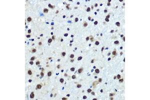 Immunohistochemistry of paraffin-embedded rat brain using hnRNP K Rabbit mAb (ABIN7267634) at dilution of 1:100 (40x lens). (HNRNPK 抗体)