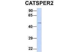 Host:  Rabbit  Target Name:  CATSPER2  Sample Type:  Human 293T  Antibody Dilution:  1. (CATSPER2 抗体  (N-Term))