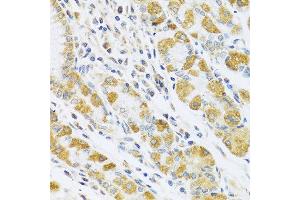 Immunohistochemistry of paraffin-embedded human stomach using PSG1 antibody at dilution of 1:100 (40x lens). (PSG1 抗体)