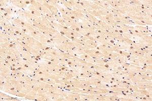 Immunohistochemistry analysis of paraffin-embedded mouse heart using,NOS1AP (ABIN7074844) at dilution of 1: 4000 (NOS1AP 抗体)