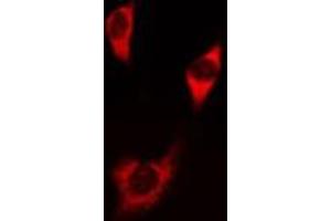ABIN6275828 staining NIH-3T3 cells by IF/ICC. (PIK3 gamma 抗体  (C-Term))