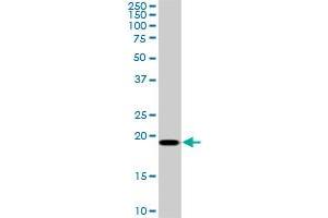 SRI monoclonal antibody (M01), clone 1E12. (SRI 抗体  (AA 1-198))