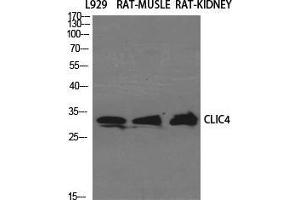 Western Blot (WB) analysis of specific cells using CLIC4 Polyclonal Antibody. (CLIC4 抗体  (N-Term))