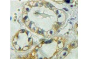 Used in DAB staining on fromalin fixed paraffin-embedded Kidney tissue (PTPRM 抗体  (AA 1197-1403))