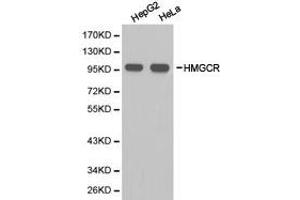 Western Blotting (WB) image for anti-3-Hydroxy-3-Methylglutaryl-CoA Reductase (HMGCR) antibody (ABIN1873048) (HMGCR 抗体)