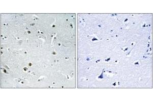 Immunohistochemistry (IHC) image for anti-DEAD (Asp-Glu-Ala-Asp) Box Polypeptide 24 (DDX24) (AA 41-90) antibody (ABIN2890149) (DDX24 抗体  (AA 41-90))