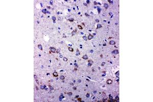 Anti-TRPC6 antibody, IHC(P) IHC(P): Rat Brain Tissue