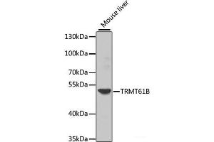Western blot analysis of extracts of Mouse liver using TRMT61B Polyclonal Antibody at dilution of 1:1000. (TRMT61B 抗体)