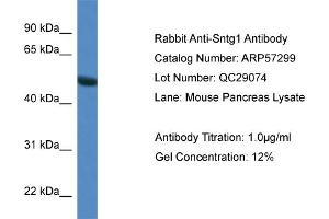 Western Blotting (WB) image for anti-Syntrophin, gamma 1 (SNTG1) (N-Term) antibody (ABIN2787161) (Syntrophin gamma 1 抗体  (N-Term))