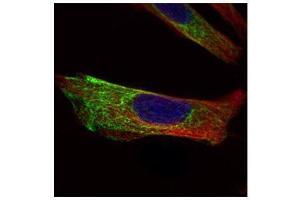 ICC/IF Image Confocal immunofluorescence analysis (Olympus FV10i) of paraformaldehyde-fixed HeLa, using Cytokeratin 17, antibody (Green) at 1:500 dilution. (KRT17 抗体)