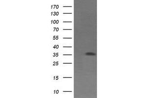 Western Blotting (WB) image for anti-T-cell surface glycoprotein CD1c (CD1C) antibody (ABIN1497192) (CD1c 抗体)