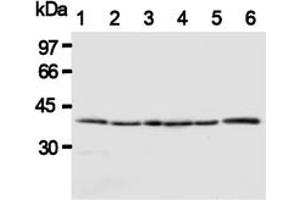 Western Blotting (WB) image for anti-HtrA Serine Peptidase 2 (HTRA2) antibody (ABIN1107619)