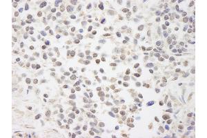 Immunohistochemistry (IHC) image for anti-Chromosome 7 Open Reading Frame 27 (C7orf27) (C-Term) antibody (ABIN7448427) (BAAT1 抗体  (C-Term))
