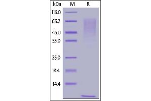 Human Mucin-1 , His Tag on  under reducing (R) condition. (MUC1 Protein (AA 890-1158) (His tag))