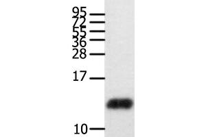 Western Blot analysis of Human brain glioma tissue using CCL28 Polyclonal Antibody at dilution of 1:450 (CCL28 抗体)