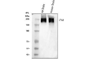 Western blot analysis of TNR using anti-TNR antibody (ABIN4886752). (Tenascin R 抗体  (C-Term))