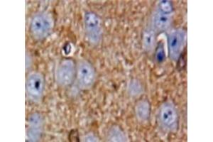 Used in DAB staining on fromalin fixed paraffin-embedded Brain tissue (PAK4 抗体  (AA 299-542))