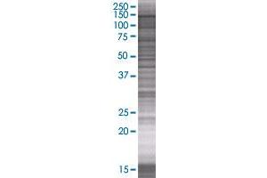 Western Blotting (WB) image for DNMT3A 293T Cell Transient Overexpression Lysate(Denatured) (ABIN1331604)