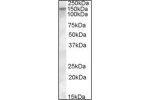 Image no. 2 for anti-Solute Carrier Family 12 (Potassium-Chloride Transporter) Member 4 (SLC12A4) (Internal Region) antibody (ABIN372748) (SLC12A4 抗体  (Internal Region))