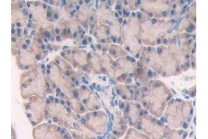 Immunohistochemistry (IHC) image for anti-Myosin, Light Chain 6B, Alkali, Smooth Muscle and Non-Muscle (MYL6B) (AA 6-137) antibody (ABIN7439591)