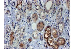 Immunohistochemical staining of paraffin-embedded Human Kidney tissue using anti-PGM3 mouse monoclonal antibody. (Phosphoglucomutase 3 抗体)