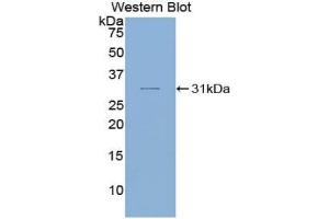 Western blot analysis of the recombinant protein. (SMAD6 抗体  (AA 116-364))