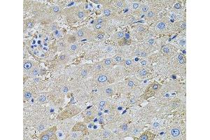 Immunohistochemistry of paraffin-embedded Human liver using GLA Polyclonal Antibody at dilution of 1:100 (40x lens). (GLA 抗体)