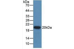Detection of Recombinant GREM1, Human using Polyclonal Antibody to Gremlin 1 (GREM1) (GREM1 抗体  (AA 26-184))