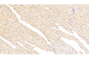 Immunohistochemistry (IHC) image for anti-Mast/stem Cell Growth Factor Receptor (KIT) (AA 343-527) antibody (ABIN7431110)