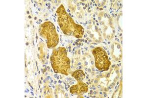 Immunohistochemistry of paraffin-embedded Human kidney using PRKCE antibody (ABIN5971136) at dilution of 1/100 (40x lens). (PKC epsilon 抗体)
