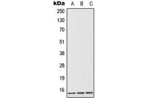 Western blot analysis of FABP1 expression in HeLa (A), Jurkat (B), rat liver (C) whole cell lysates. (FABP1 抗体  (Center))