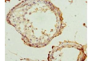 Immunohistochemistry of paraffin-embedded human testis tissue using ABIN7168074 at dilution of 1:100 (Rhotekin 抗体  (AA 304-563))