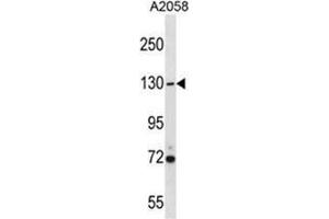USP7 Antibody (Center) western blot analysis in A2058 cell line lysates (35 µg/lane).