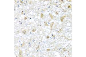 Immunohistochemistry (IHC) image for anti-ATPase, Ca++ Transporting, Type 2C, Member 1 (ATP2C1) (AA 400-660) antibody (ABIN3016170)