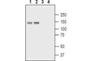 Western blot analysis of rat stomach lysate (lanes 1 and 3) and rat lung membranes (lanes 2 and 4): - 1,2. (ATP2B4 抗体  (2nd Cytoplasmic Loop))