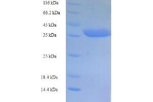 SDS-PAGE (SDS) image for Caspase 5, Apoptosis-Related Cysteine Peptidase (CASP5) (AA 137-327), (partial) protein (His-SUMO Tag) (ABIN4974670) (CASP5 Protein (AA 137-327, partial) (His-SUMO Tag))