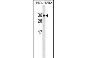 IL34 Antibody (N-term) (ABIN1539235 and ABIN2849950) western blot analysis in NCI- cell line lysates (35 μg/lane). (IL-34 抗体  (N-Term))