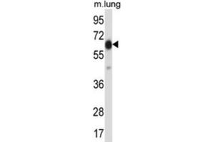 Western Blotting (WB) image for anti-Premature Ovarian Failure, 1B (POF1B) antibody (ABIN2997564) (POF1B 抗体)