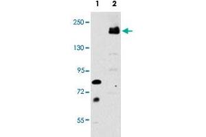 Western blot analysis of LRP6 (arrow) using rabbit LRP6 polyclonal antibody . (LRP6 抗体  (C-Term))