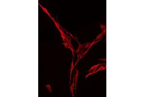 ABIN6275021 staining RAW264. (ST6GAL1 抗体  (Internal Region))