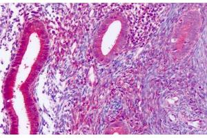 Anti-DUSP23 antibody IHC staining of human uterus, endometrium. (DUSP23 抗体  (Internal Region))