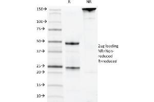 SDS-PAGE Analysis Purified CD22 Mouse Monoclonal Antibody (MYG13). (CD22 抗体)