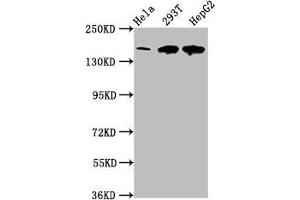 Western Blot Positive WB detected in: Hela whole cell lysate, 293T whole cell lysate, HepG2 whole cell lysate All lanes: LRPPRC antibody at 4 μg/mL Secondary Goat polyclonal to rabbit IgG at 1/50000 dilution Predicted band size: 158 kDa Observed band size: 158 kDa (LRPPRC 抗体  (AA 901-1036))