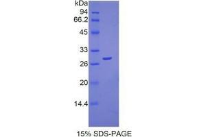 SDS-PAGE analysis of Human Peroxiredoxin 3 Protein. (Peroxiredoxin 3 Protein (PRDX3))