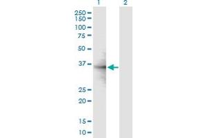 Western Blot analysis of RPL6 expression in transfected 293T cell line by RPL6 MaxPab polyclonal antibody. (RPL6 抗体  (AA 1-288))